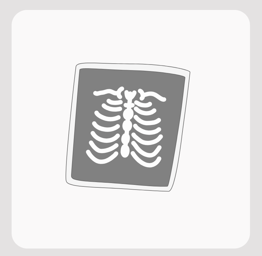 X線検査ってどんな検査？