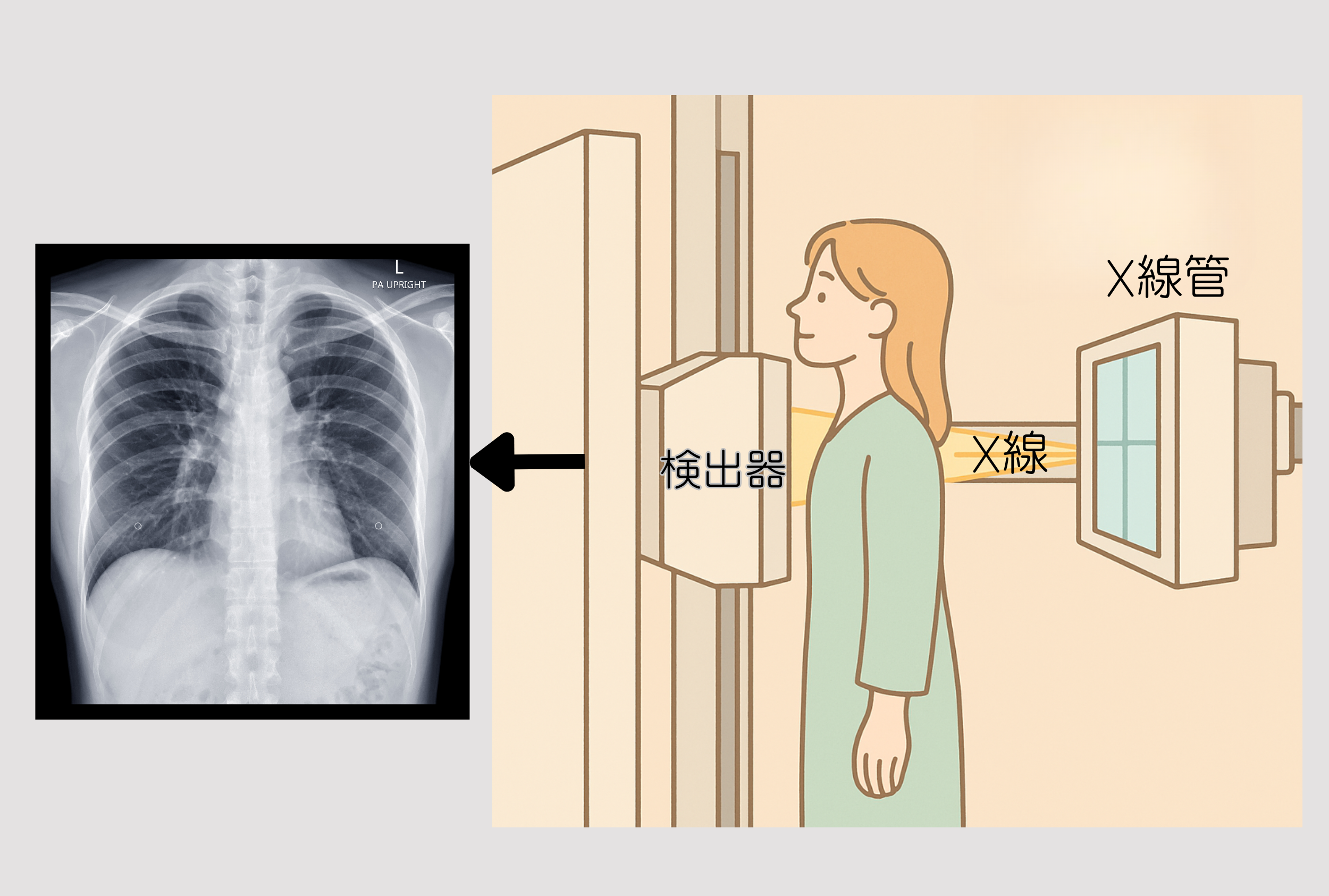 レントゲン検査のしくみ