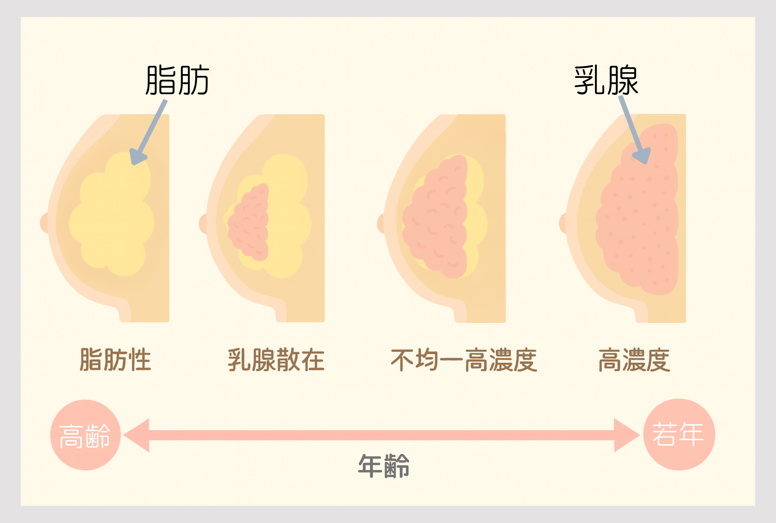 日本人の乳腺構造イラスト