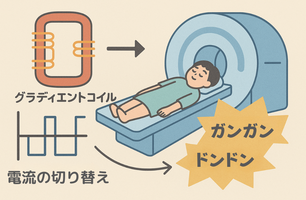 MRIがうるさい理由